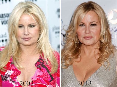 jennifer coolidge before plastic surgery|Jennifer Coolidges plastic surgery and stunning transformation